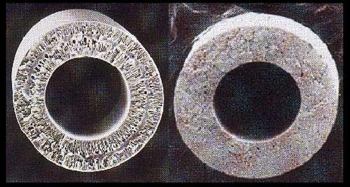 Photomicrographs of the Pall Aria hollow fibres, showing the polyacrylonitrile (PAN) fibres for ultra-filtration (left) and polyvinylideneflouride (PVDF) for micro-filtration (right).